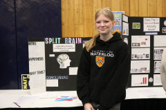 429-The-split-brain_-how-hemispheric-difference-shape-thinking